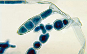 Epidermophyton floccosum